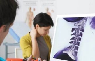 Cervical Osteochondrosis -Behandlung