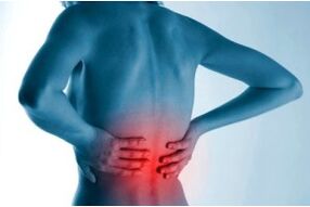 Lokalisation einer spinalen Osteochondrose.
